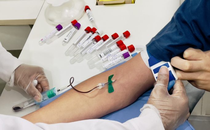 Медики переходят на российские вакуумные пробирки для взятия крови из вены