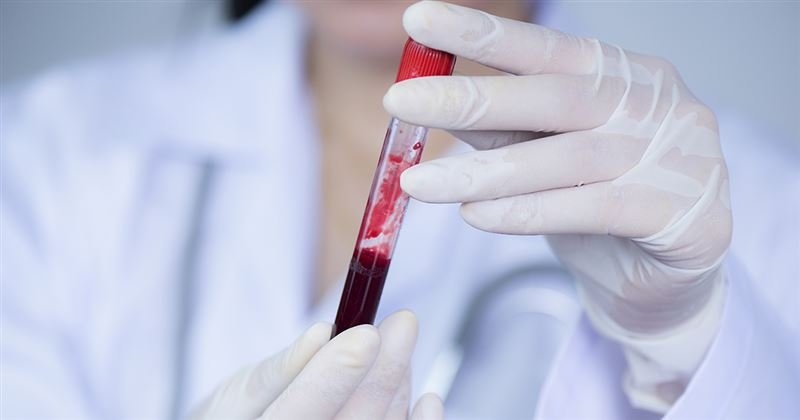 Почему образуются тромбы и как правильно разжижать кровь - ФармМедПром