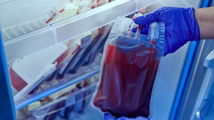 ФМБА взяло обязательство заготовить 780 тонн плазмы в 2025 году