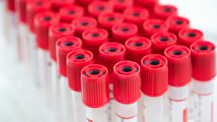 В России открыли новое производство вакуумных пробирок и заготовок для медицинских игл
