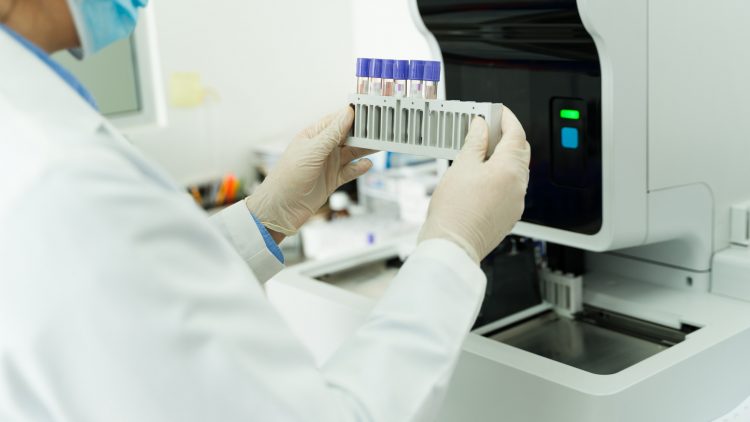 Российский «ХимМед» запустил серийное производство колонок для хроматографии