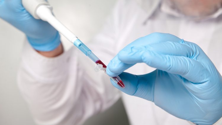 Первый в мире экспресс-тест на гепатит С создали российские ученые