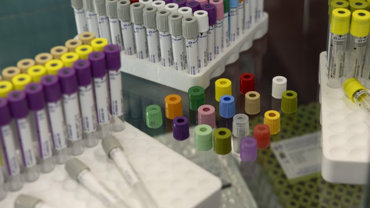 В России открыли новое производство вакуумных пробирок и заготовок для медицинских игл