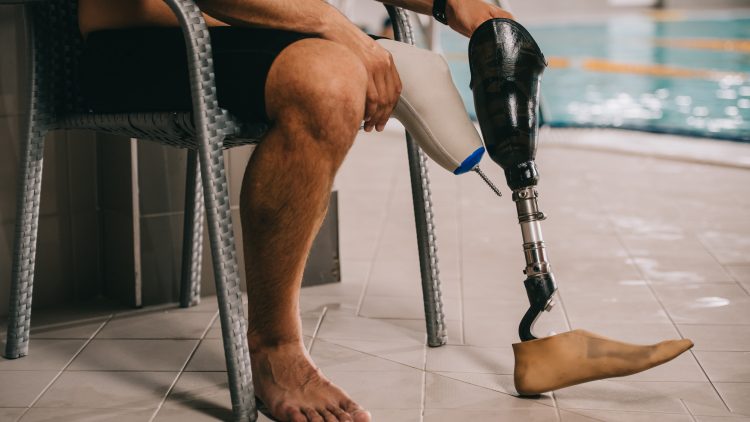 Правительство выделило на техсредства реабилитации инвалидов еще около 16 млрд рублей