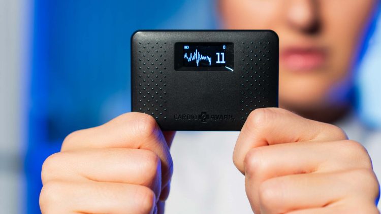 В России зарегистрировали уникальный электрокардиограф с ИИ размером с кредитку