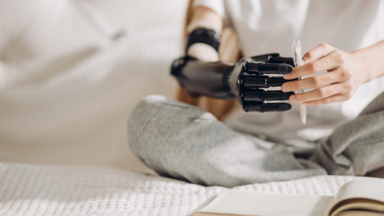 В России опробовали нейропротезы с функцией осязания, устраняющие фантомные боли после ампутации