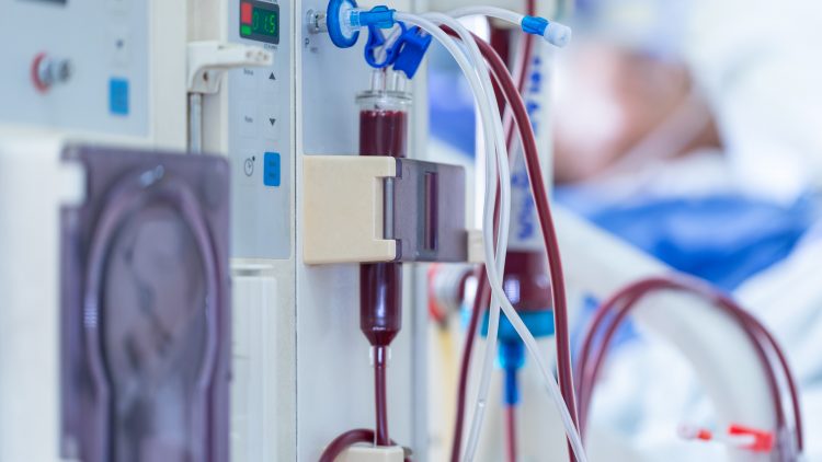 Правительство хочет оперативно импортозаместить продукцию для нефрологии