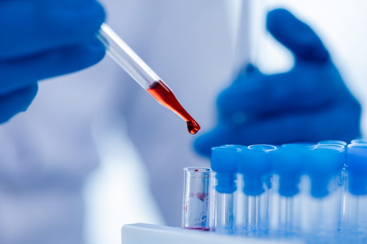 У молодых будут по-новому проверять риски для сердца