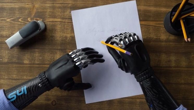 Эксперты назвали меры для ускорения развития отрасли бионических протезов в России