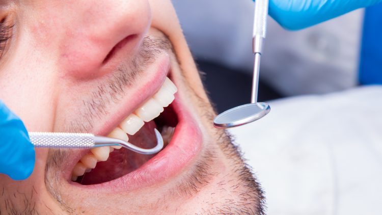 В России представили уникальную систему ранней диагностики рака полости рта