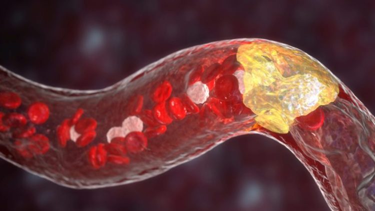 «Хороший» холестерин может быть не таким уж хорошим