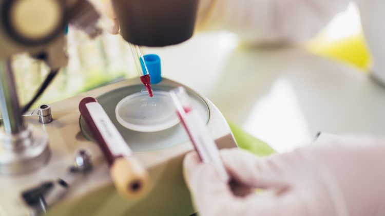 С 7 до 15 предлагают расширить панель биомаркеров старения, доступных по ОМС