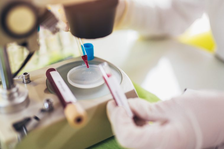 С 7 до 15 предлагают расширить панель биомаркеров старения, доступных по ОМС