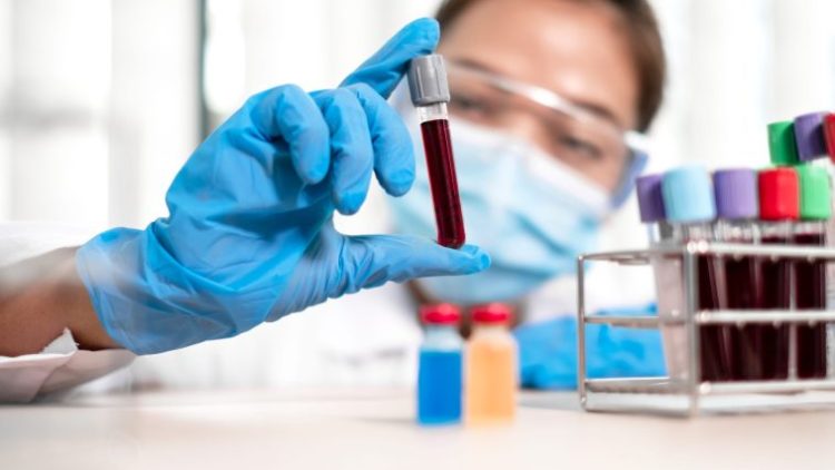 Первая отечественная CAR-T-терапия для лечения онкологических заболеваний крови показала свою эффективность