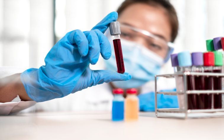 Первая отечественная CAR-T-терапия для лечения онкологических заболеваний крови показала свою эффективность