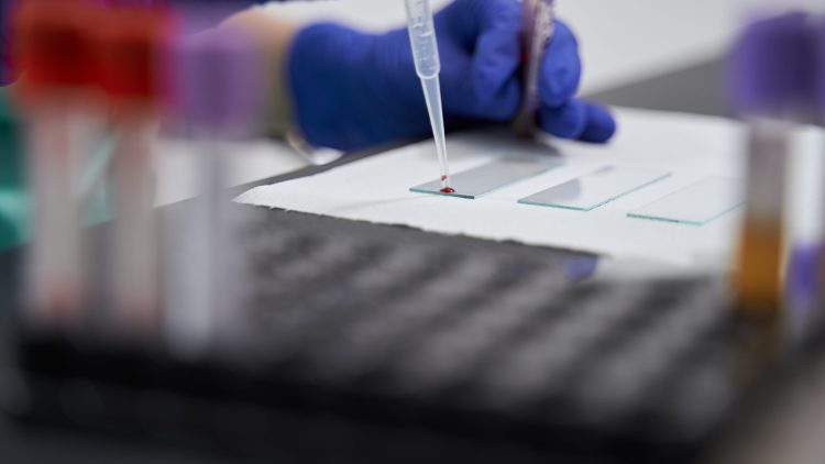 Минздрав призвал к массовому тестированию россиян на ВИЧ